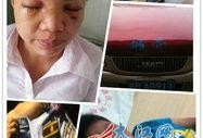 赣州爆料小孩被打伤视频,被打伤小孩的痛与反思